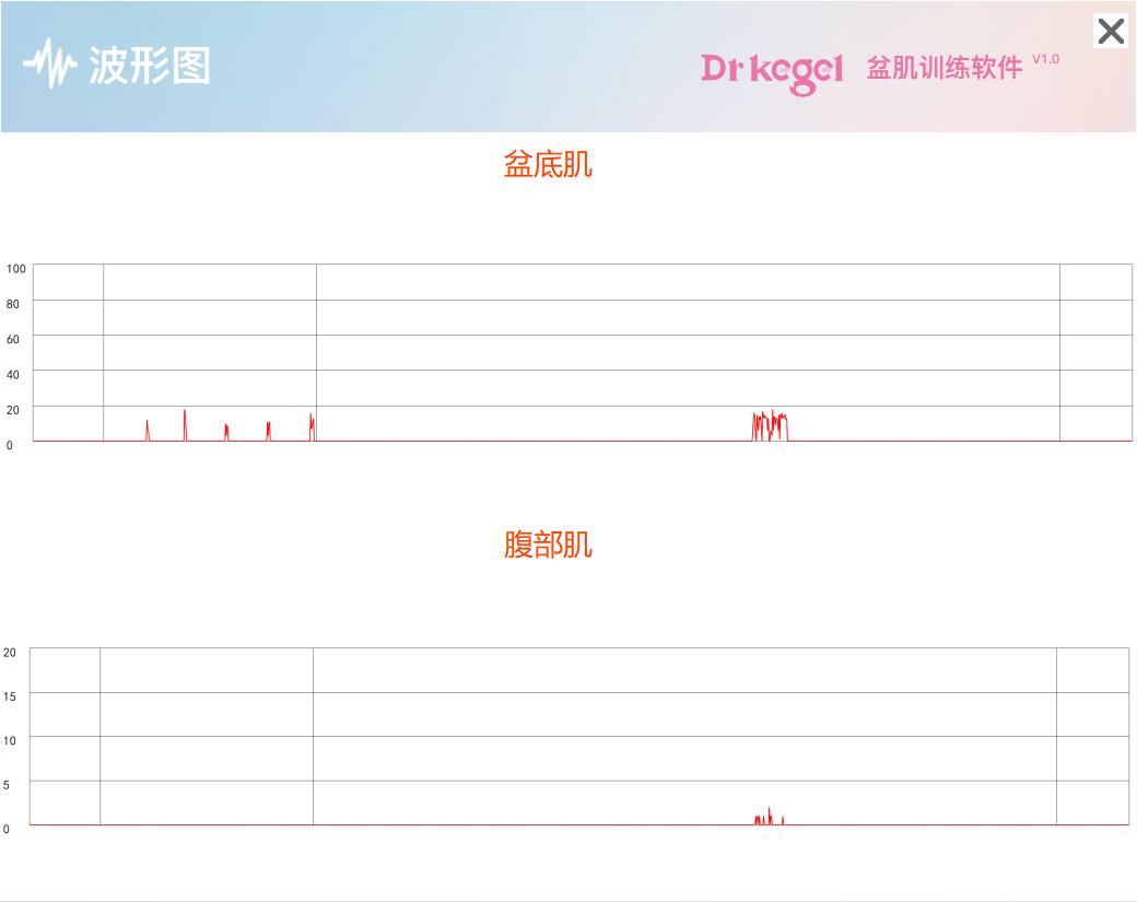 kegel盆底肌修复仪波形图